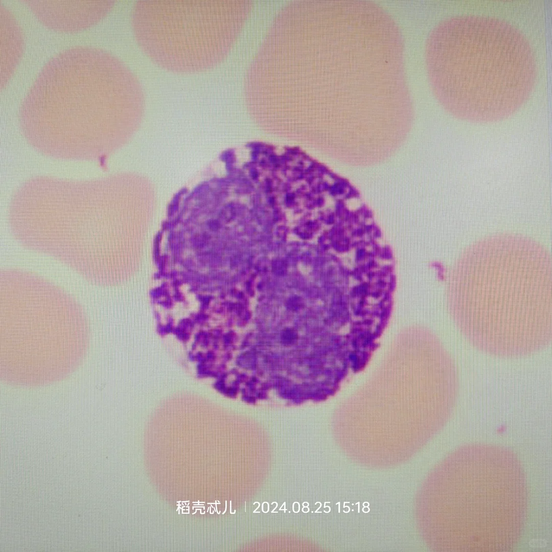 嗜碱性粒细胞