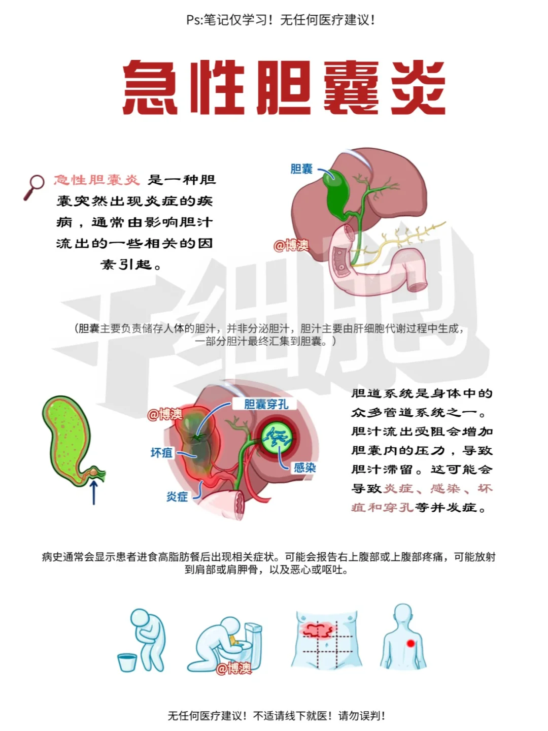 🍍：急性胆囊炎|笔记