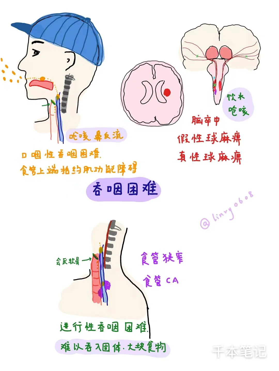 医学生绘本🎨第28弹【吞咽困难】