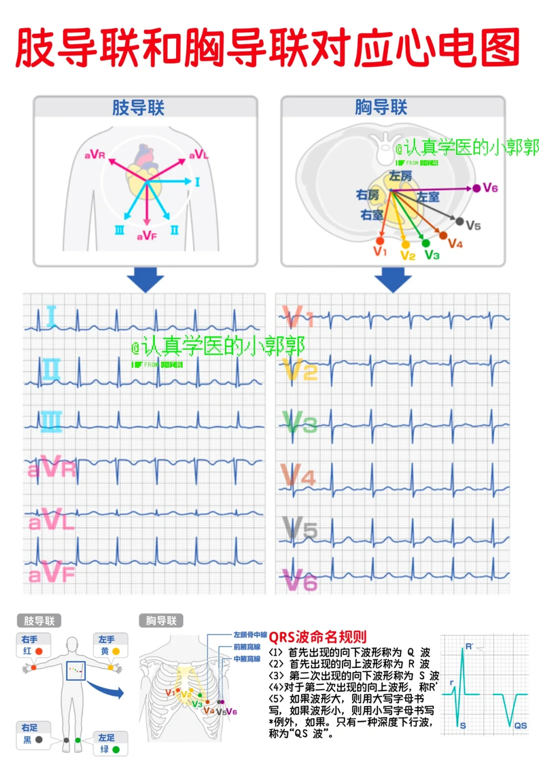 心电图的12导联