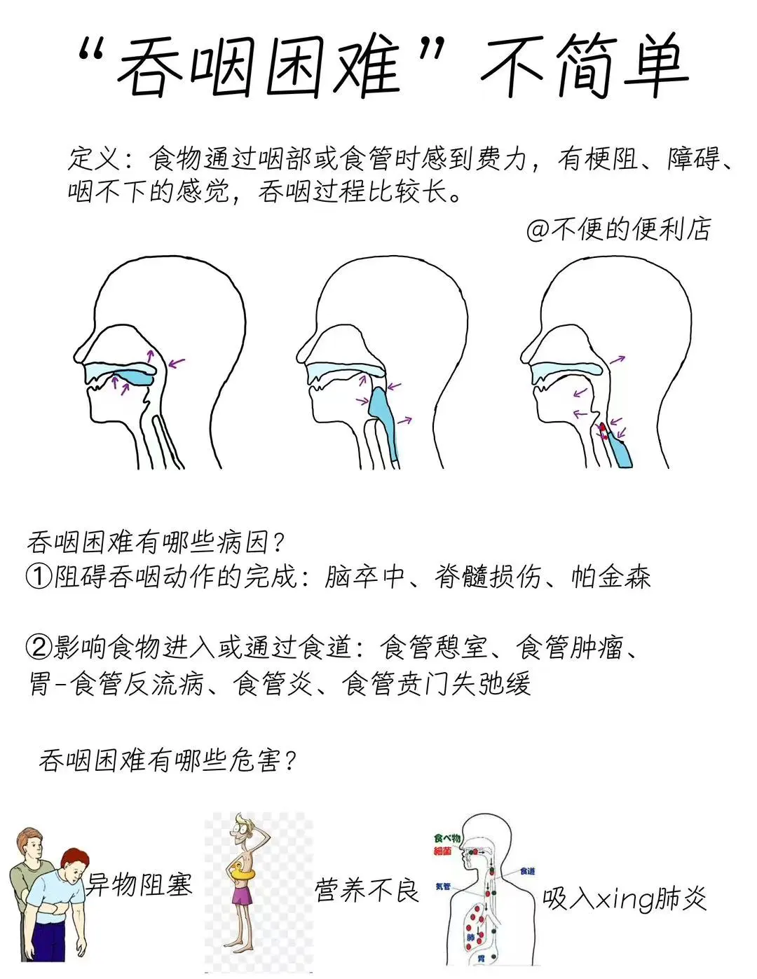 医学生笔记📝 |吞咽困难