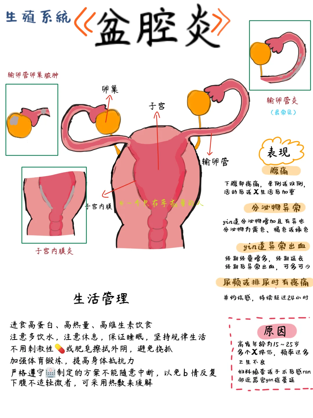 🔆盆腔炎小百科💡