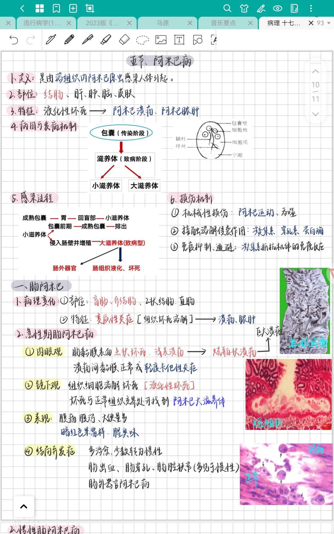 病理学｜十七章 感染性疾病